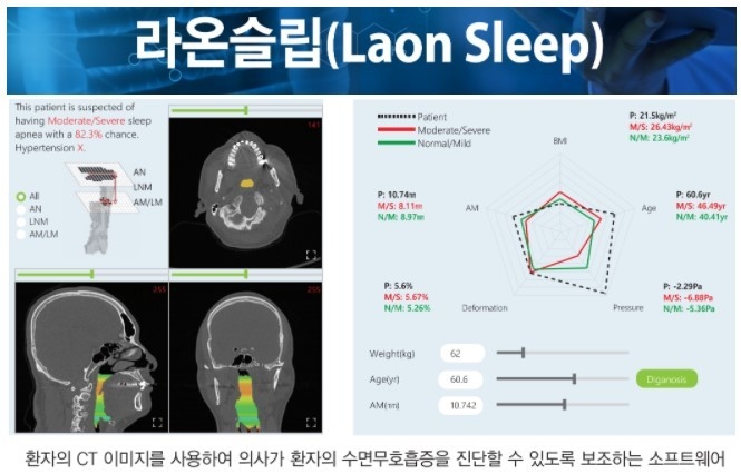 대한민국 11호 혁신의료기기 라온슬립 (출처 : 라온피플)