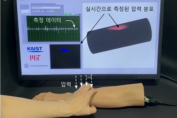 생체모사 로봇피부의 구조를 미용 의수에 적용한 예. (출처 : KAIST)