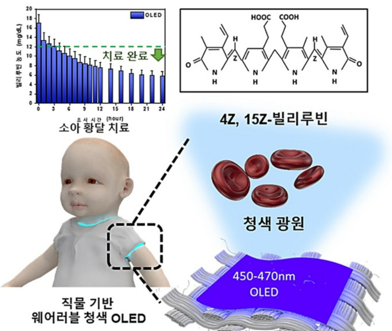 직물 기반 웨어러블 청색 OLED 신생아 황달 치료 개념도 (출처 : 한국과학기술원)