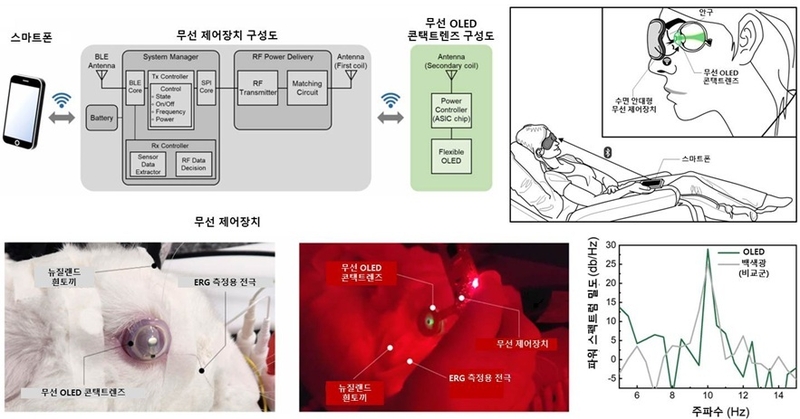 무선 OLED 콘택트렌즈를 활용한 망막전위도 검사 (출처 : KAIST)